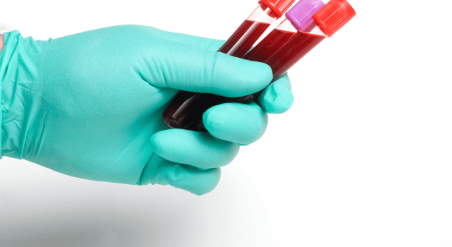 Coronavirus, Saccardi: “Si può continuare a donare sangue in piena sicurezza”