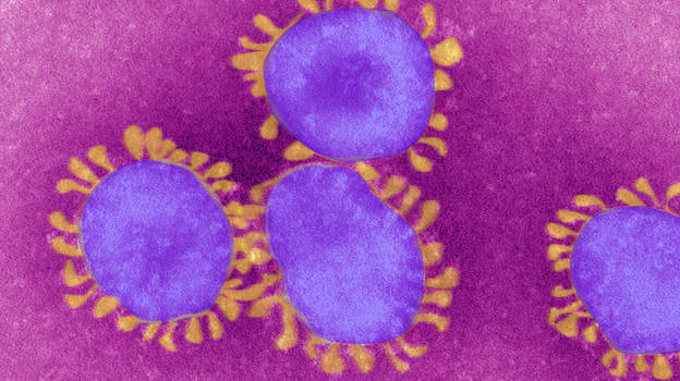 Coronavirus: 85 nuovi casi con età media di 41 anni, 1 decesso