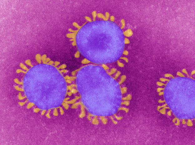 Coronavirus: 85 nuovi casi con età media di 41 anni, 1 decesso