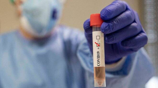 Coronavirus: in Toscana 93 nuovi casi, 12 decessi, 292 guarigioni e 28 ricoveri in meno