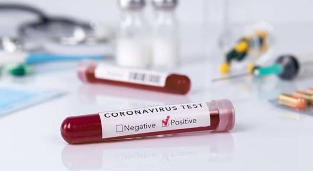Coronavirus, 73 casi in più rispetto a ieri e nessun decesso