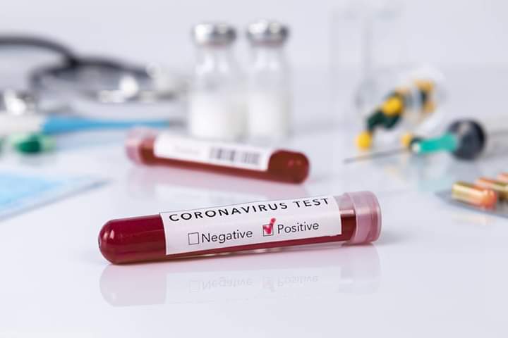 Coronavirus: 906 nuovi casi, età media 42 anni, 5 decessi